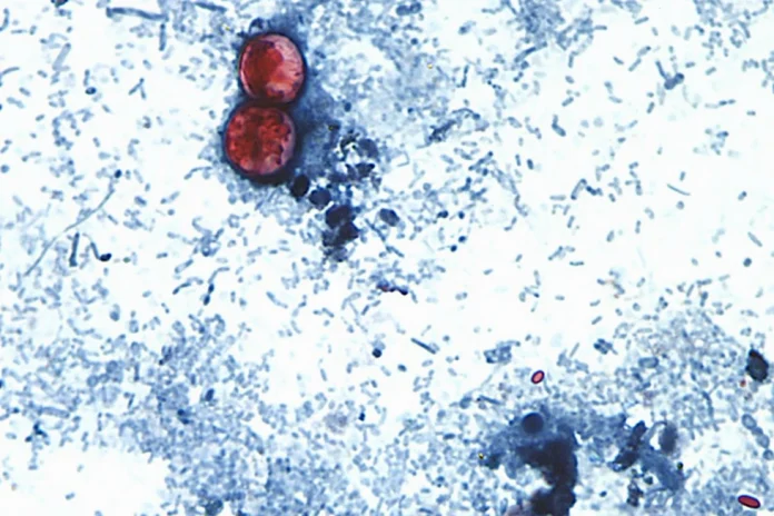 Brote de ciclosporiasis vinculado a lechuga se extiende a 15 estados de EEUU, dicen los CDC